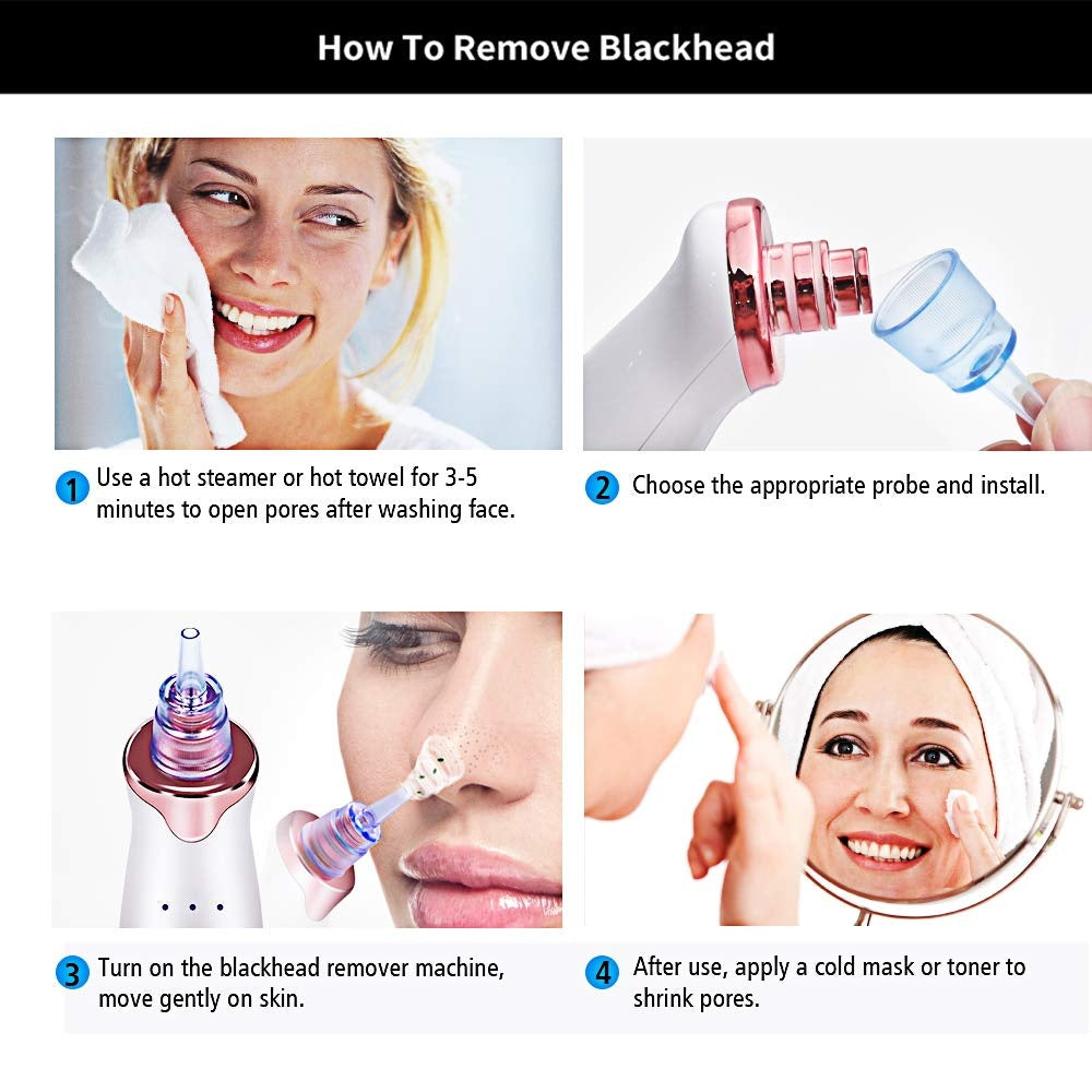 Electric Blackhead Remover