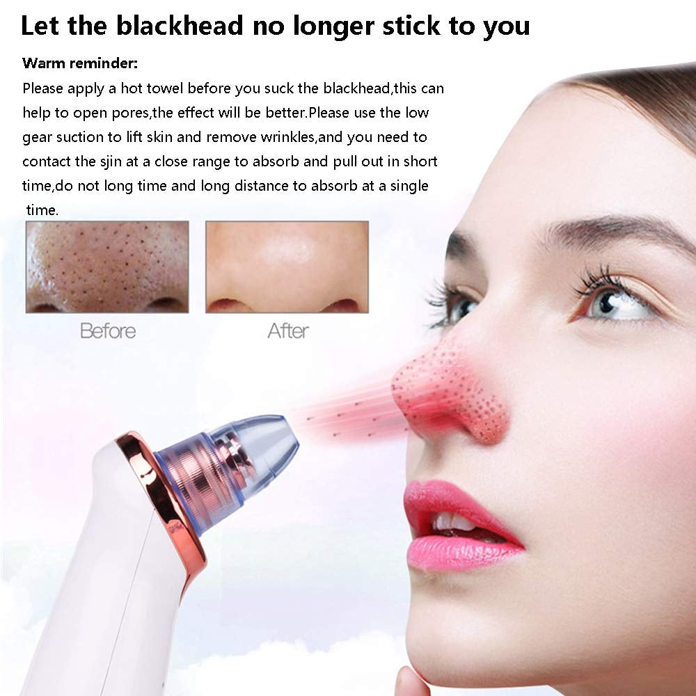 Electric Blackhead Remover